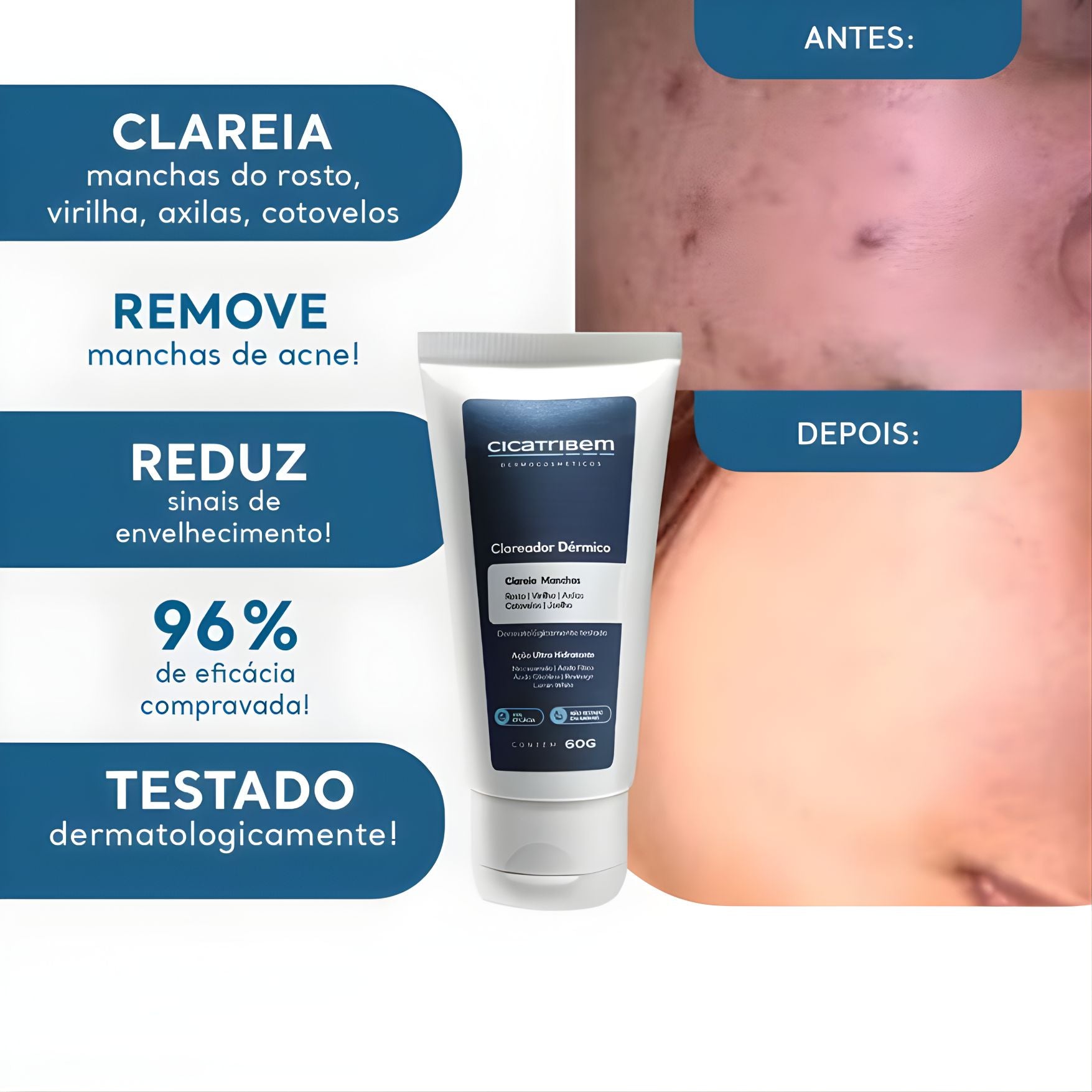 Clareador Melasma Virilha e Axilas 60g - Cicatribem Original