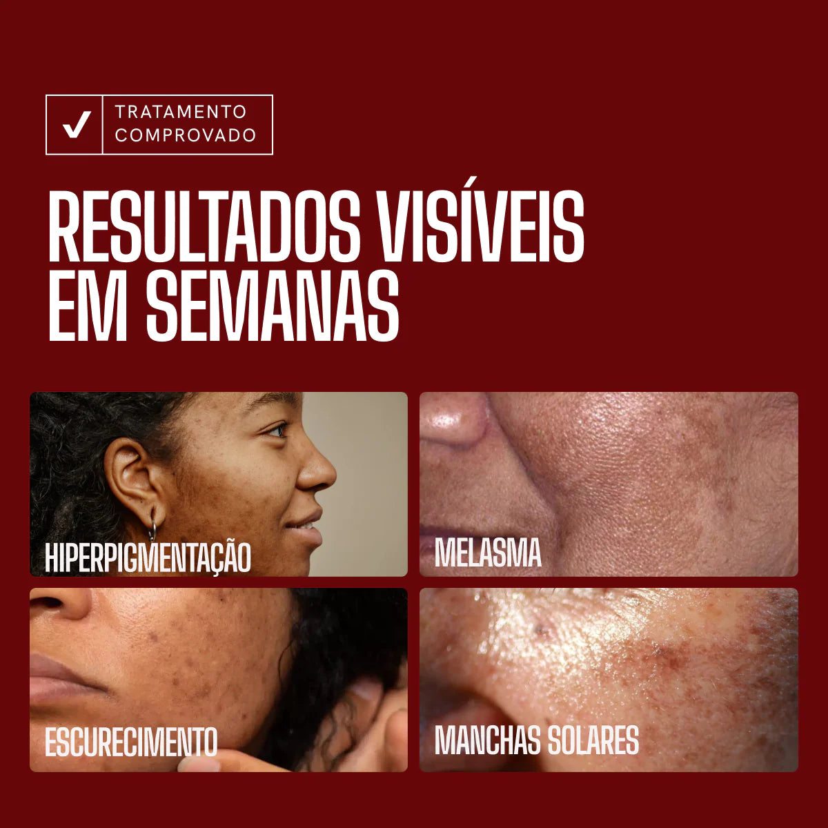 Sérum Clareador Anti-manchas Envy Skin Ácido Original