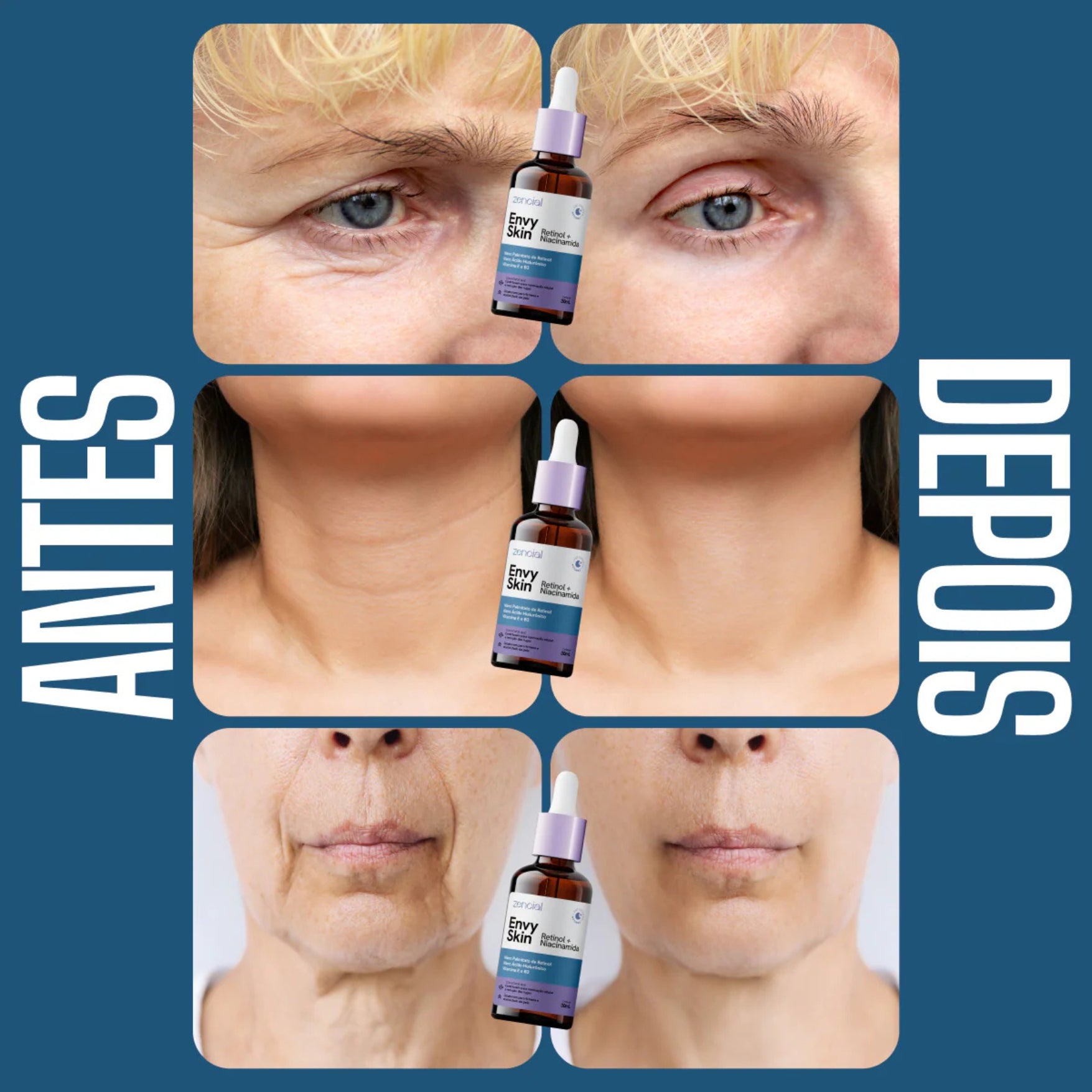 Estimulador Sérum Facial Retinol + Niacinamida Zencial Anti-idade Rugas