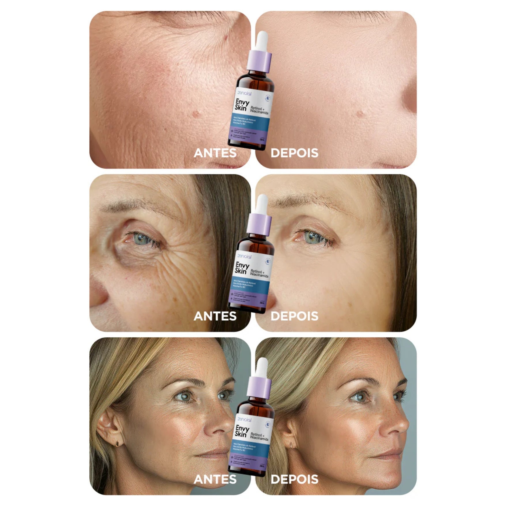 Estimulador Sérum Facial Retinol + Niacinamida Zencial Anti-idade Rugas